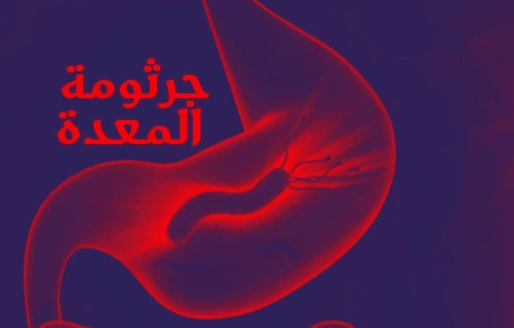 كم يستمر علاج جرثومة المعدة اكتشف المدة الفعالة لعلاج نهائي يخلصك من الألم!